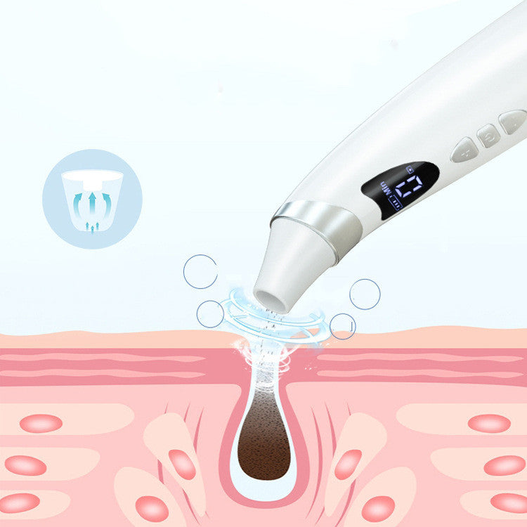 Electric Visual Blackhead Suction Cleaner