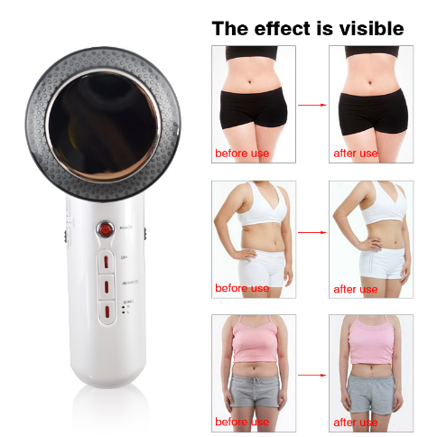 Beauty Care Slimming Ultrasound Body Fat Remove Massager - Shopeez